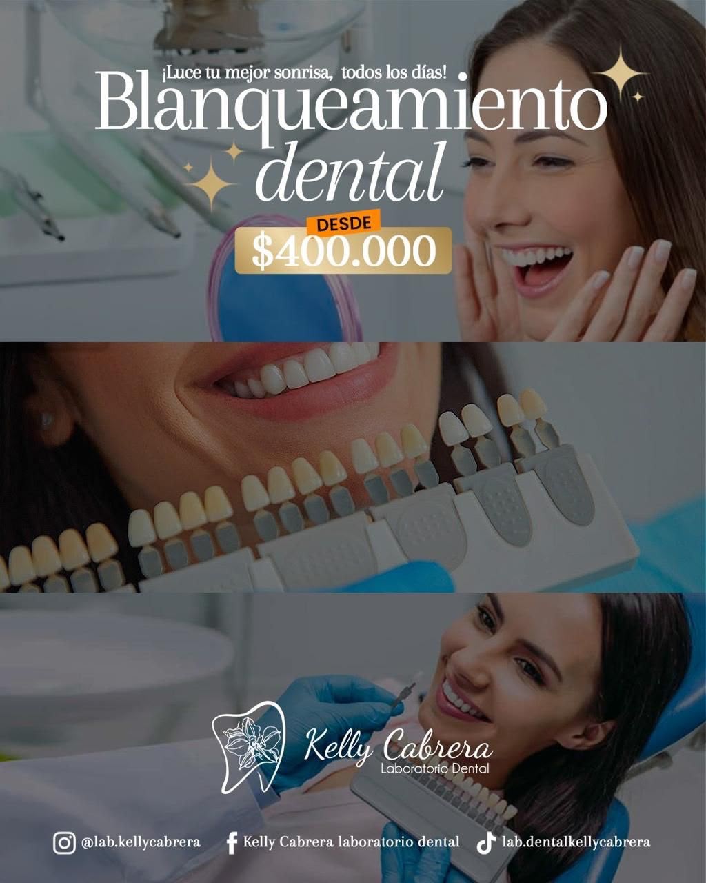 Estética Dental
