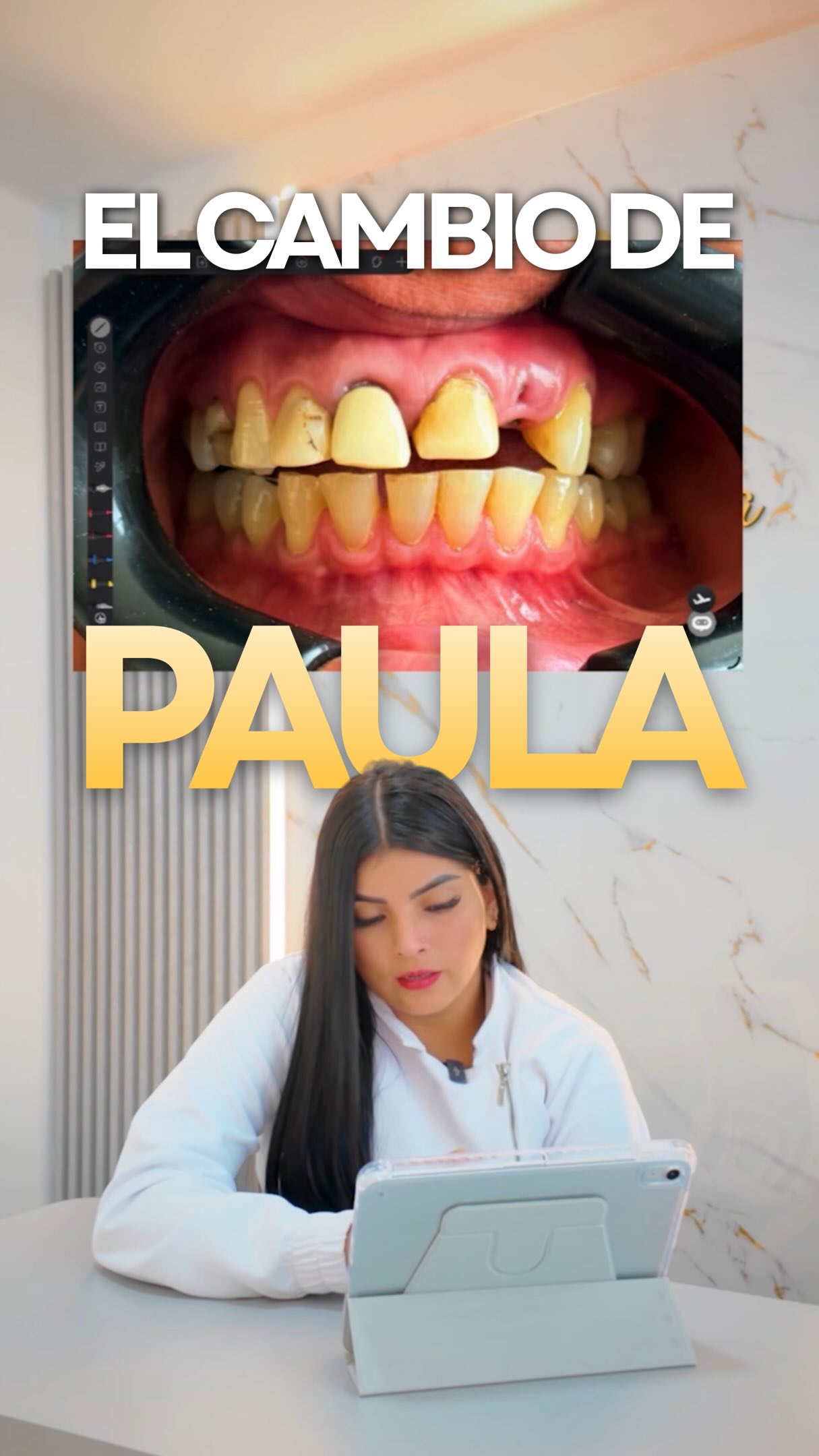 Procesos