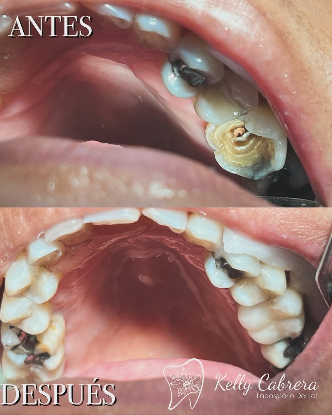 Antes y Después