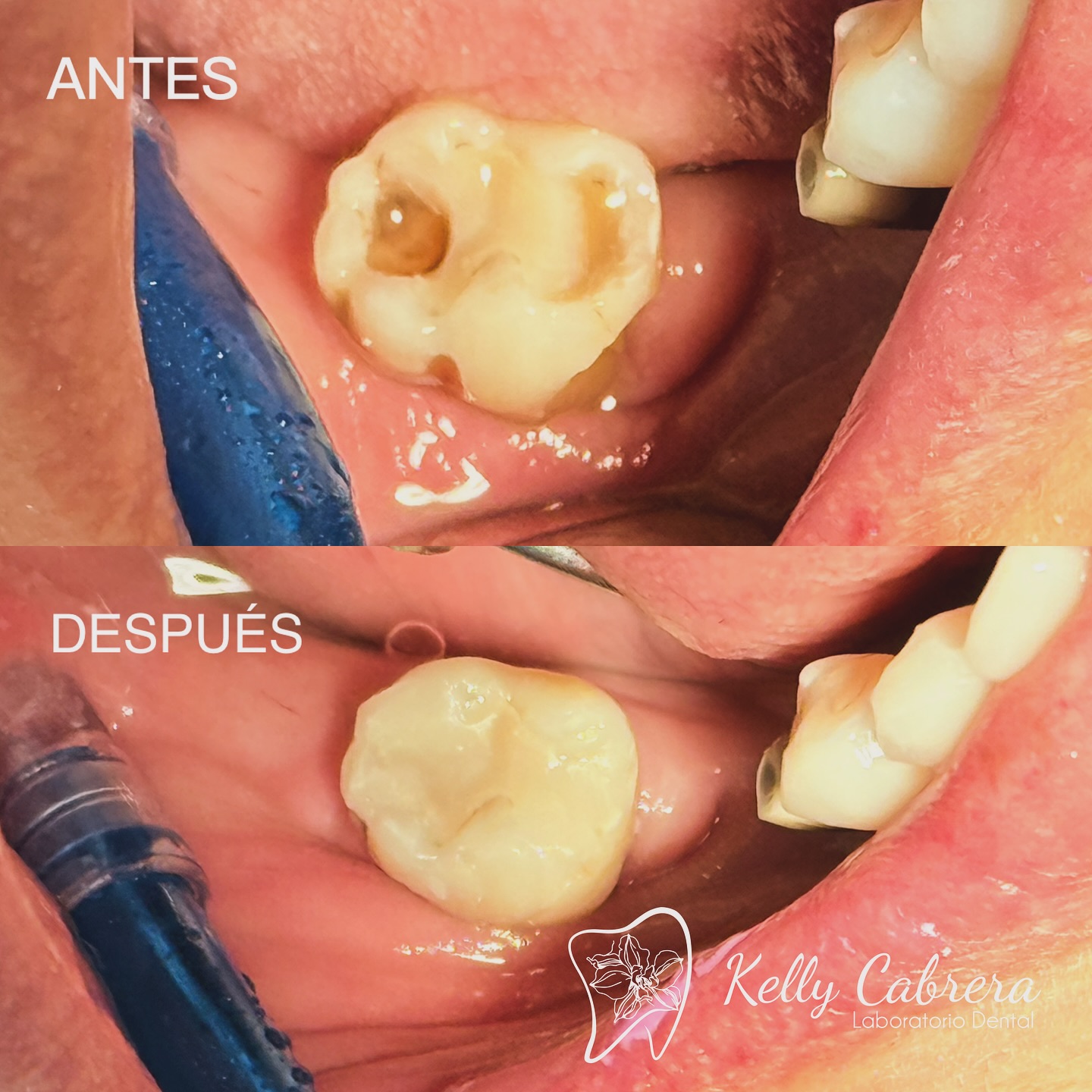 Antes y Después